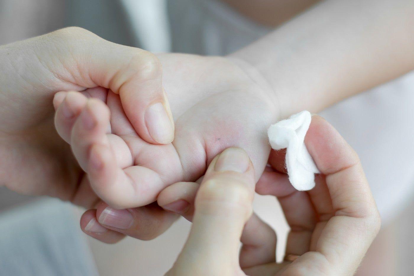 Removing a splinter from a toddler's hand
